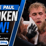 jake paul broken jaw